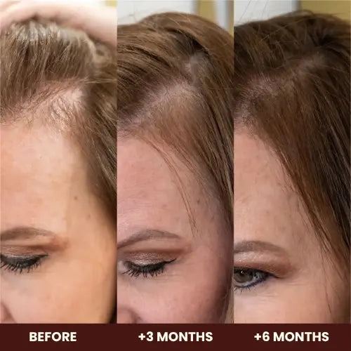 Hair, Skin & Nails Growth Gummies