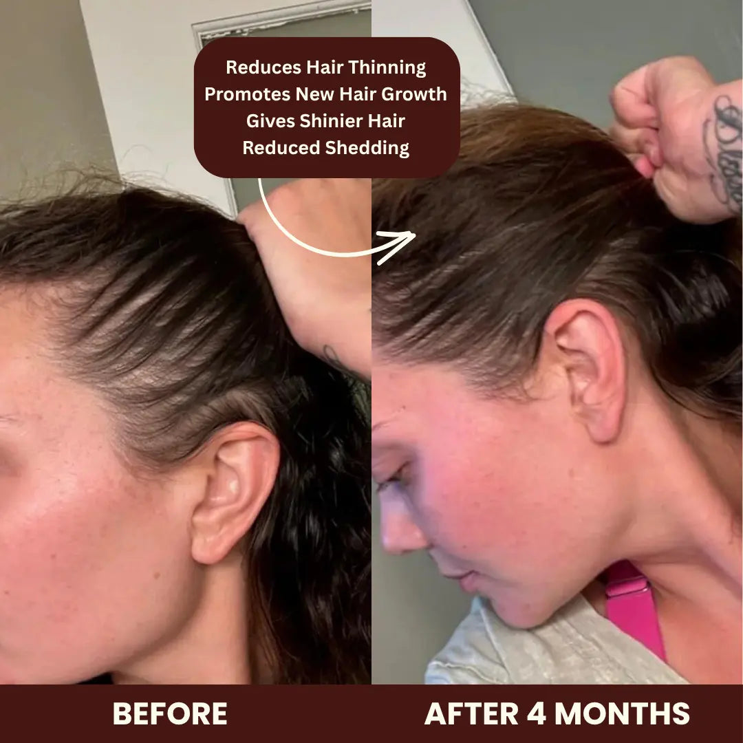 Hair, Skin & Nails Growth Gummies