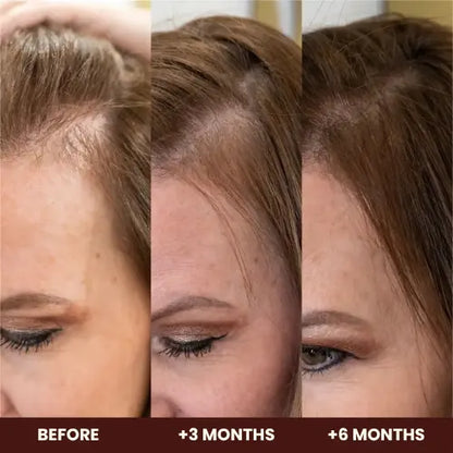 Hair, Skin & Nails Growth Gummies
